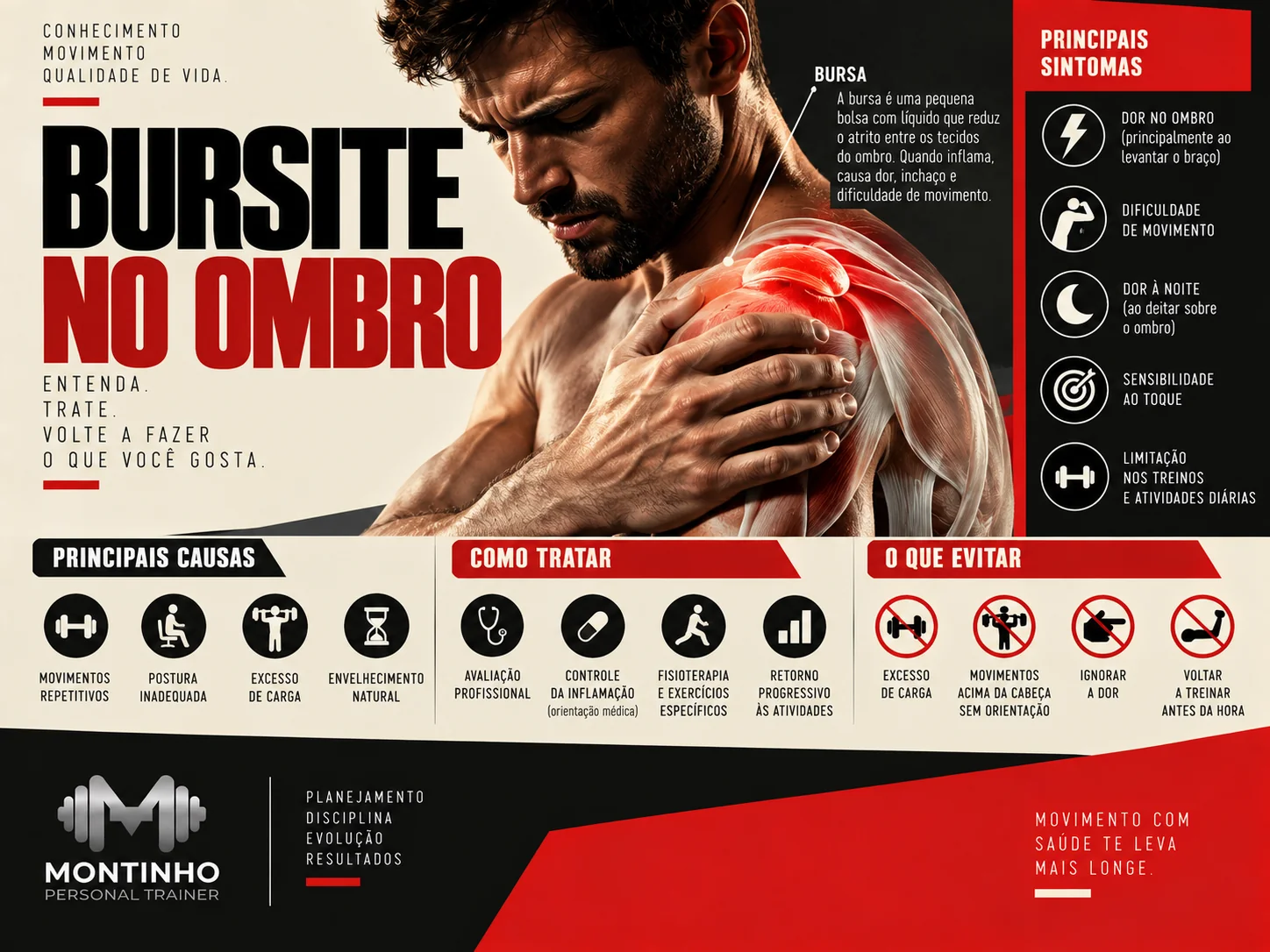 Arte de capa ilustrada sobre bursite no ombro, identificação da dor e retorno seguro ao treino